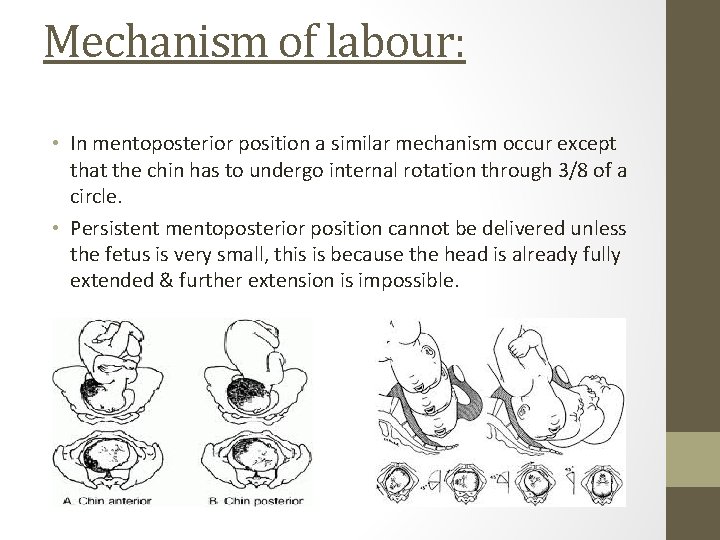 Mechanism of labour: • In mentoposterior position a similar mechanism occur except that the