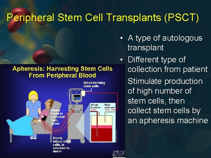 Peripheral Stem Cell Transplants (PSCT) • A type of autologous transplant • Different type