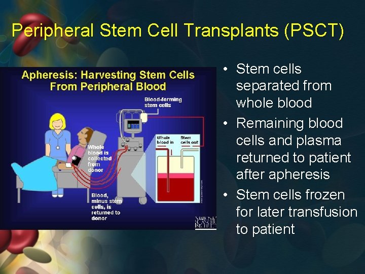 Peripheral Stem Cell Transplants (PSCT) • Stem cells separated from whole blood • Remaining