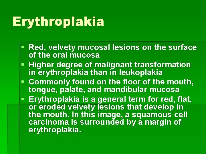 Erythroplakia § Red, velvety mucosal lesions on the surface of the oral mucosa §