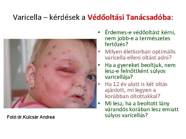 Varicella – kérdések a Védőoltási Tanácsadóba: Fotó: dr. Kulcsár Andrea • Érdemes-e védőoltást kérni,