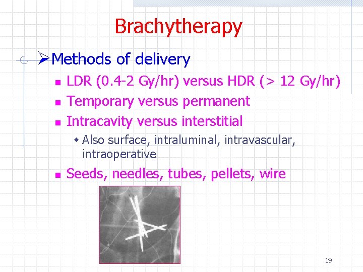 Brachytherapy ØMethods of delivery n n n LDR (0. 4 -2 Gy/hr) versus HDR