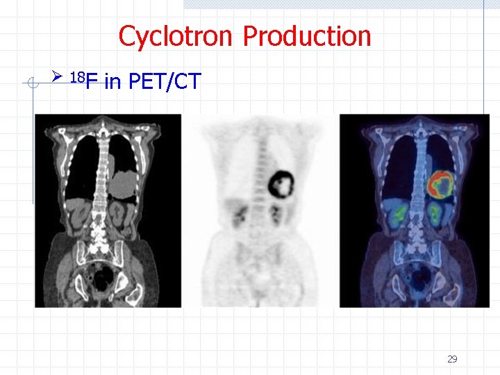 Cyclotron Production Ø 18 F in PET/CT 29 