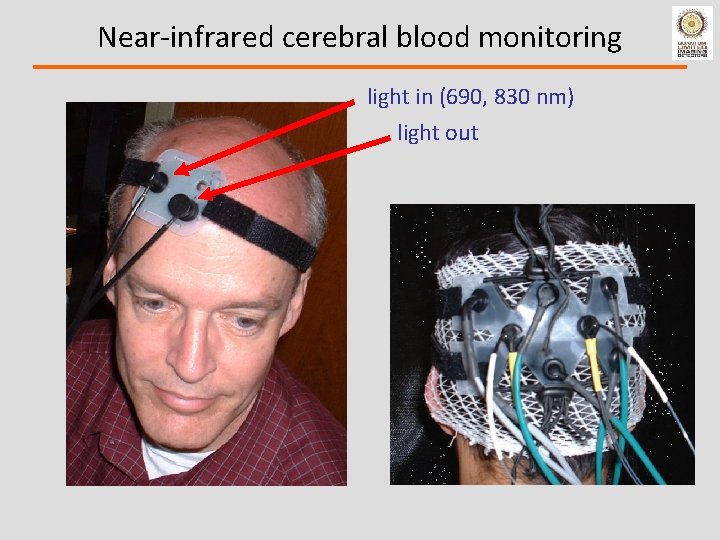 Near-infrared cerebral blood monitoring light in (690, 830 nm) light out 