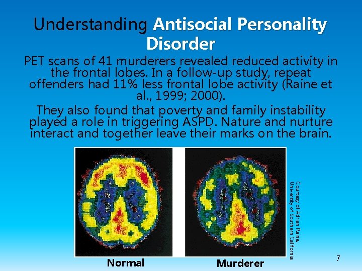 Understanding Antisocial Personality Disorder PET scans of 41 murderers revealed reduced activity in the