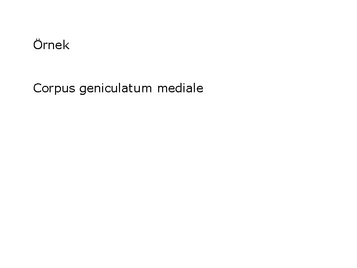 Örnek Corpus geniculatum mediale 