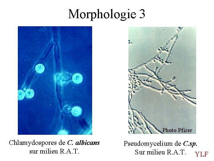 Morphologie 3 Photo Pfizer Chlamydospores de C. albicans sur milieu R. A. T. Pseudomycelium