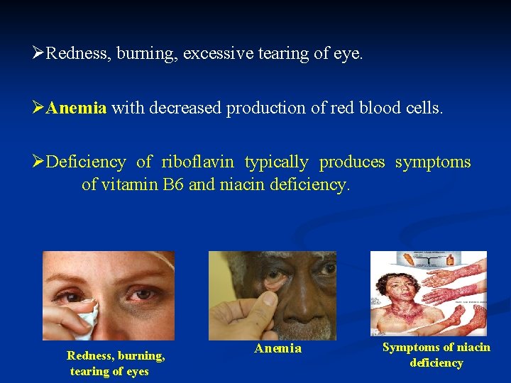 ØRedness, burning, excessive tearing of eye. ØAnemia with decreased production of red blood cells.