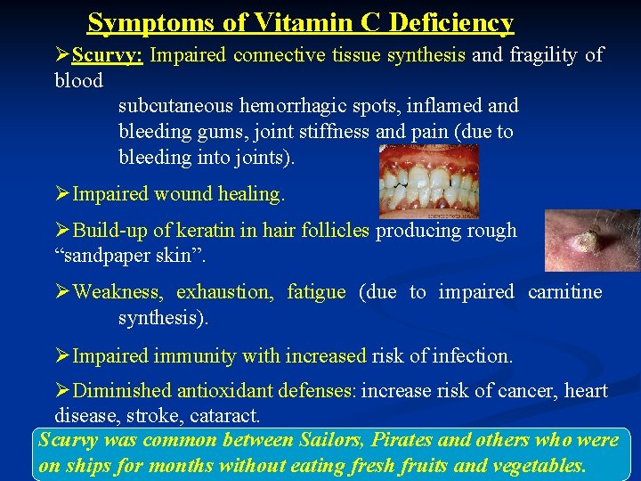 Symptoms of Vitamin C Deficiency ØScurvy: Impaired connective tissue synthesis and fragility of blood