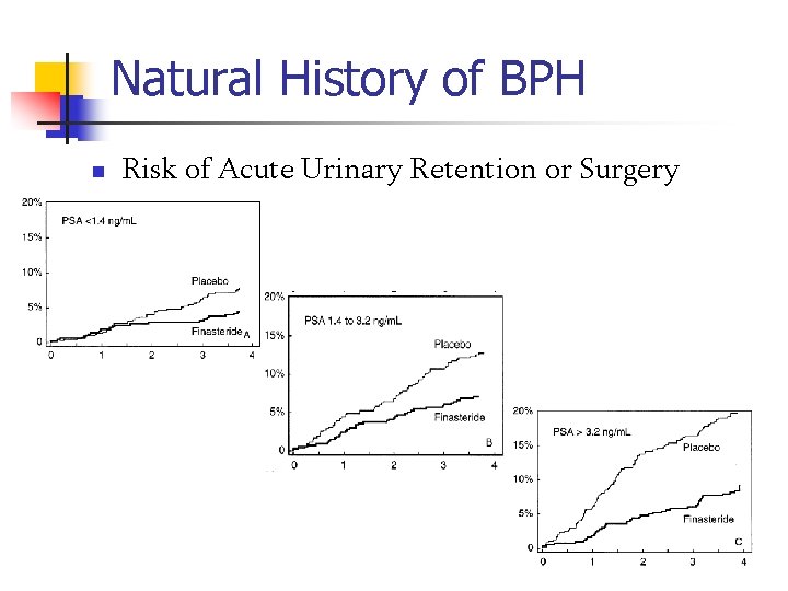 Natural History of BPH n Risk of Acute Urinary Retention or Surgery 