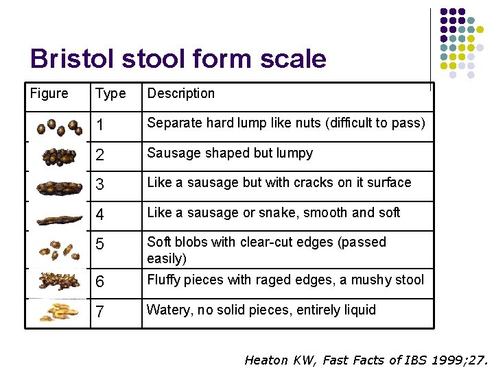 Bristol stool form scale Figure Type Description 1 Separate hard lump like nuts (difficult