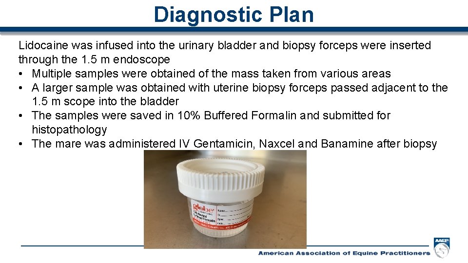 Diagnostic Plan Lidocaine was infused into the urinary bladder and biopsy forceps were inserted