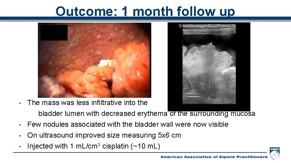 Outcome: 1 month follow up • • The mass was less infiltrative into the