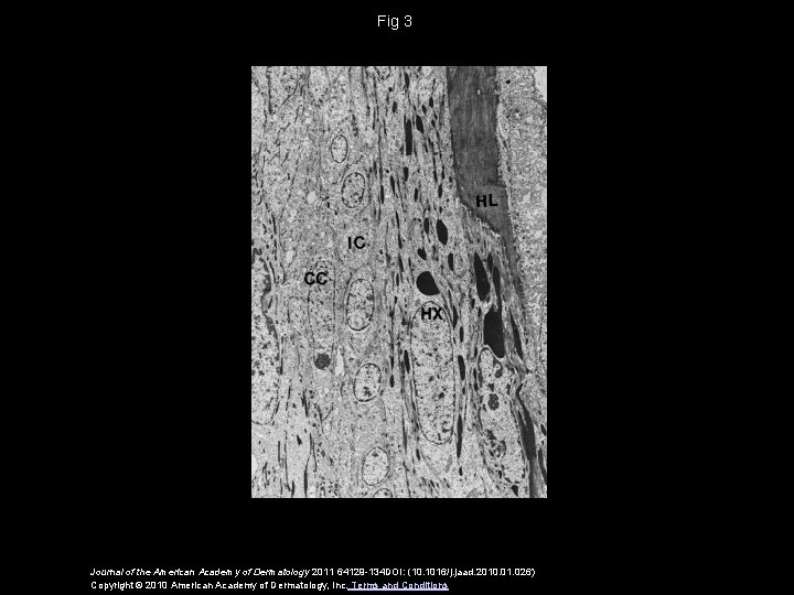 Fig 3 Journal of the American Academy of Dermatology 2011 64129 -134 DOI: (10.