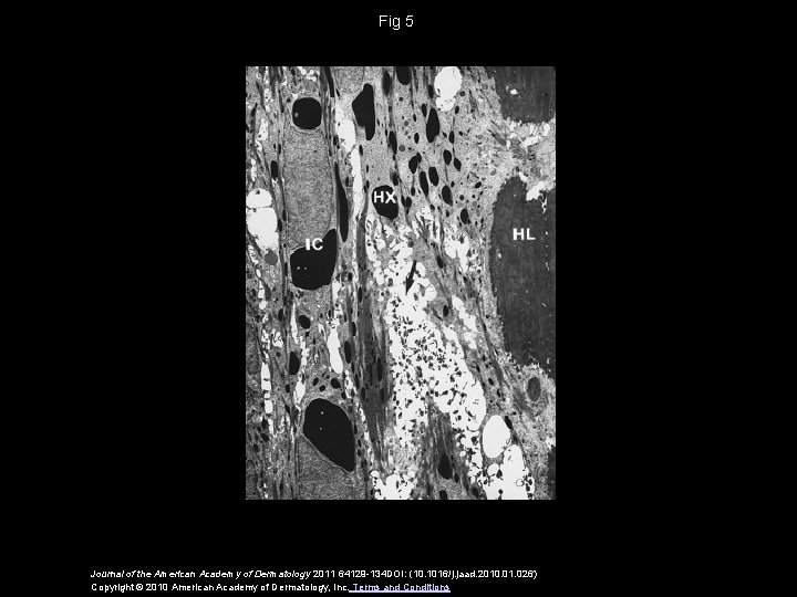 Fig 5 Journal of the American Academy of Dermatology 2011 64129 -134 DOI: (10.