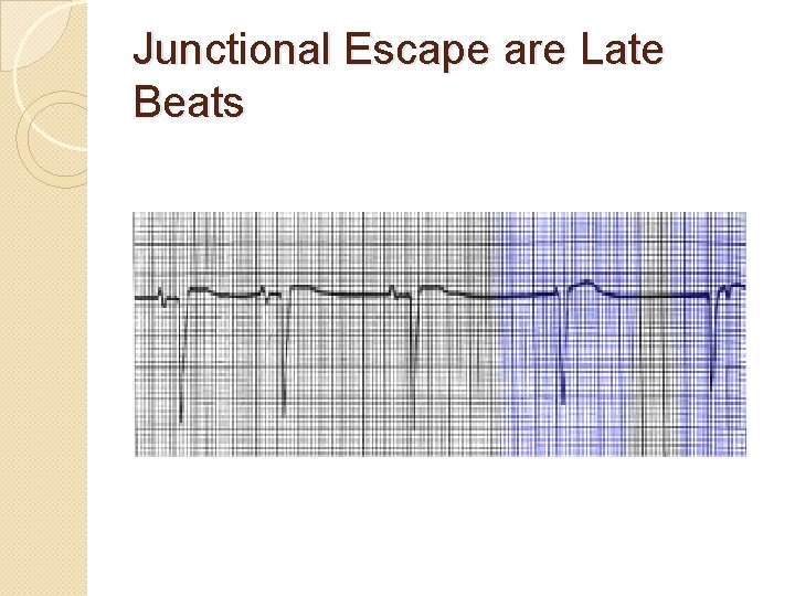 Junctional Escape are Late Beats 