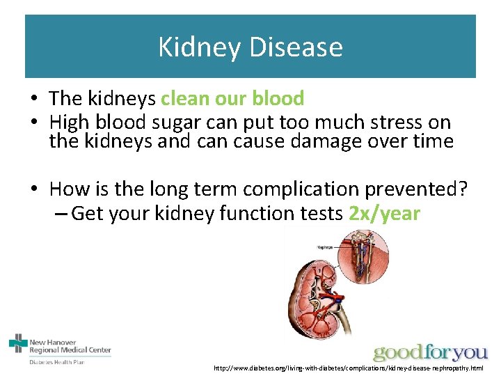 Kidney Disease • The kidneys clean our blood • High blood sugar can put