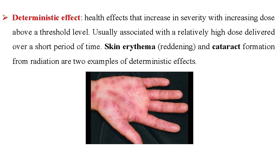 Ø Deterministic effect: health effects that increase in severity with increasing dose above a