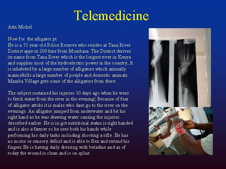 Telemedicine Attn Michel Now for the alligator pt. He is a 51 year old