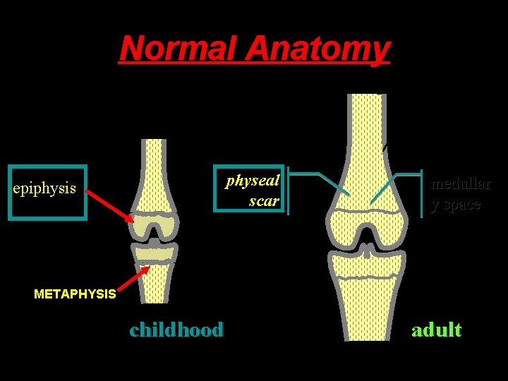 Normal Anatomy diaphysis cortex metaphysi s physeal physis scar epiphysis medullar y space METAPHYSIS