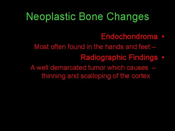 Neoplastic Bone Changes Endochondroma • Most often found in the hands and feet –