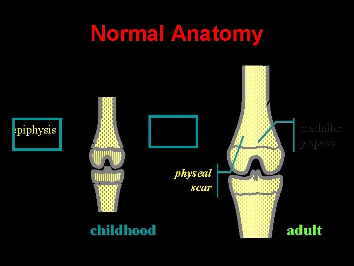 Normal Anatomy diaphysis cortex metaphysi s epiphysis medullar y space physeal scar childhood adult