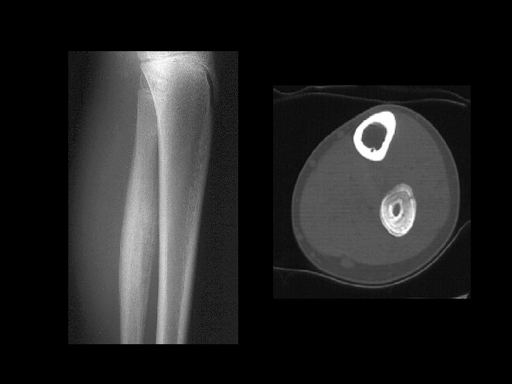 Example 9 “onion-skin” 