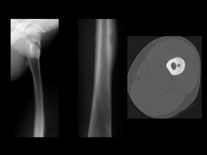 Example 8: 45 y/o with thigh pain 