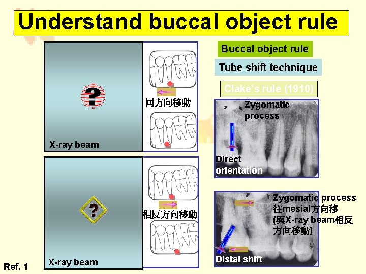 Understand buccal object rule Buccal object rule Lingual Tube shift technique Mesial shift Clake’s