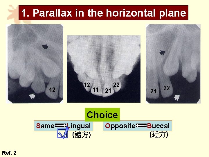 1. Parallax in the horizontal plane 12 12 11 21 22 Choice Same Ref.