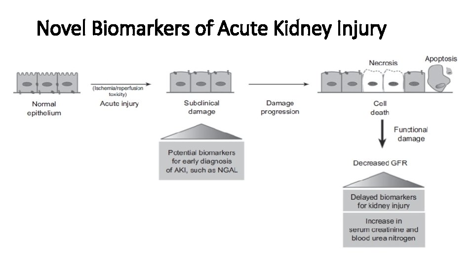 Novel Biomarkers of Acute Kidney Injury 