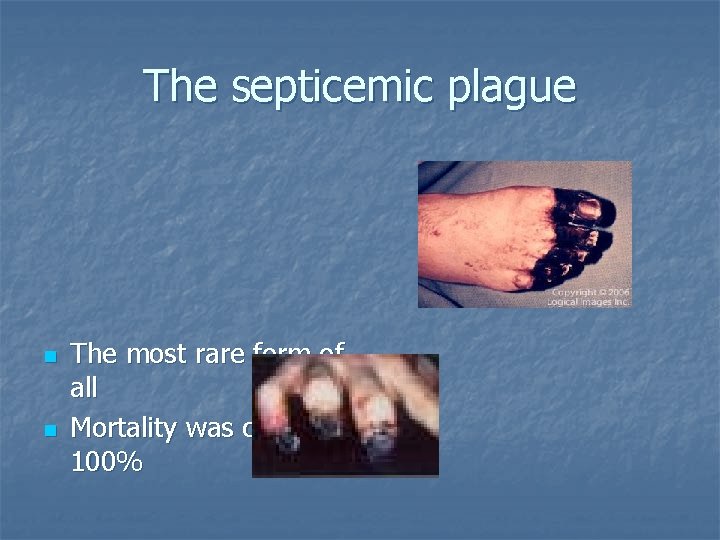 The septicemic plague n n The most rare form of all Mortality was close