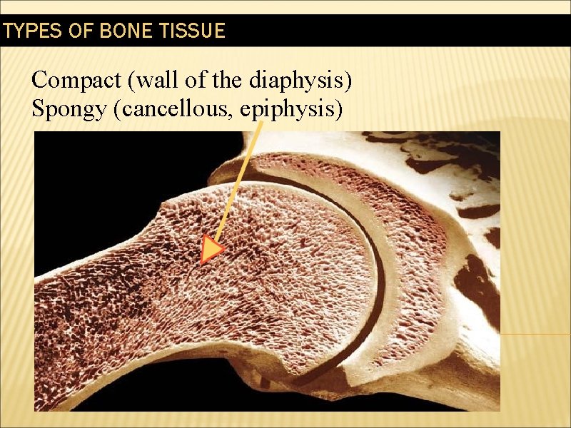 TYPES OF BONE TISSUE Compact (wall of the diaphysis) Spongy (cancellous, epiphysis) 