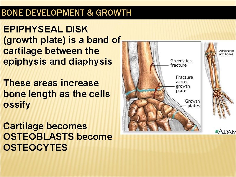 BONE DEVELOPMENT & GROWTH EPIPHYSEAL DISK (growth plate) is a band of cartilage between
