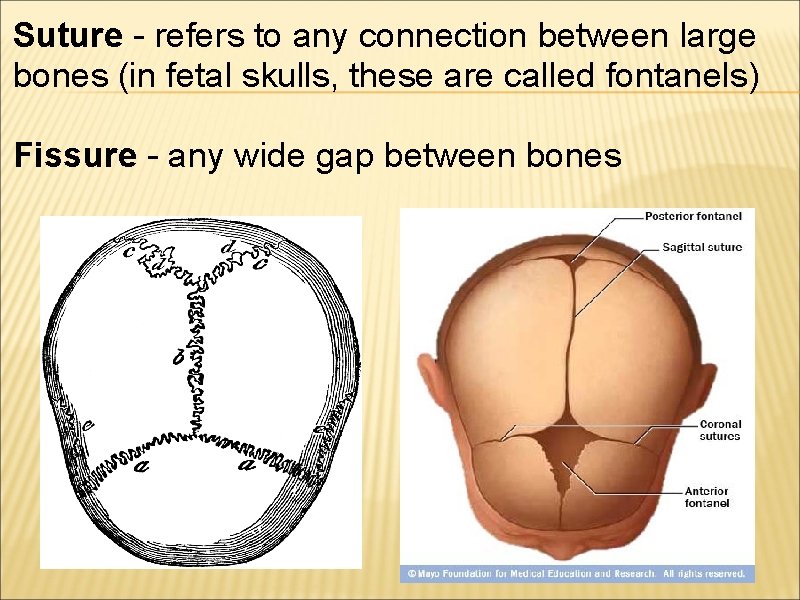 Suture - refers to any connection between large bones (in fetal skulls, these are