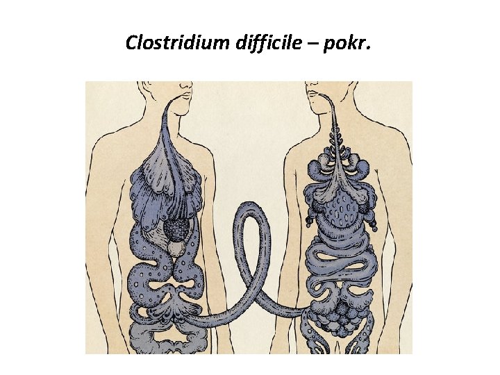 Clostridium difficile – pokr. 