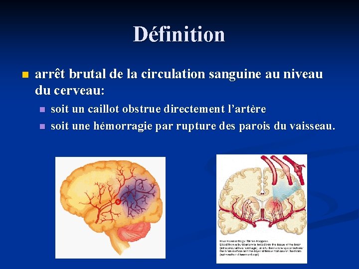 Définition n arrêt brutal de la circulation sanguine au niveau du cerveau: n n