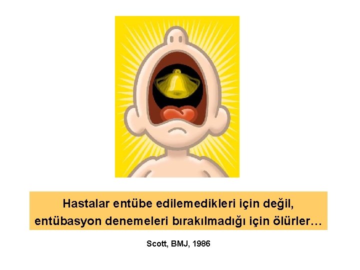 Hastalar entübe edilemedikleri için değil, entübasyon denemeleri bırakılmadığı için ölürler… Scott, BMJ, 1986 