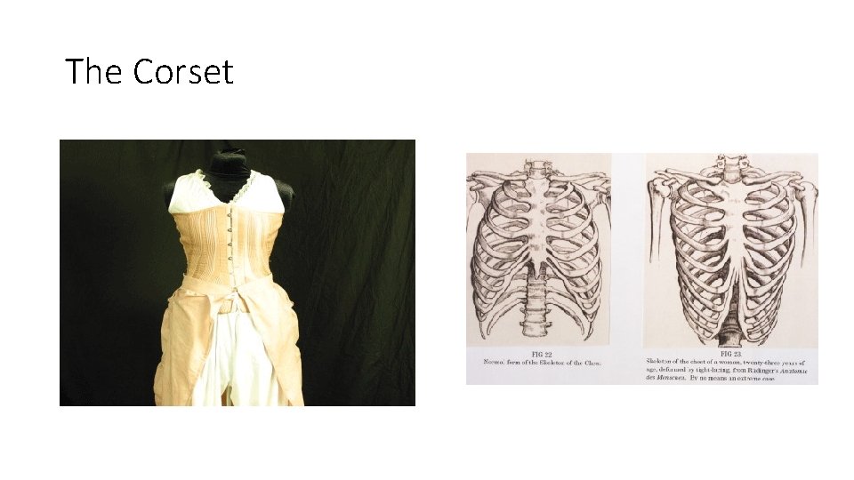 The Corset 