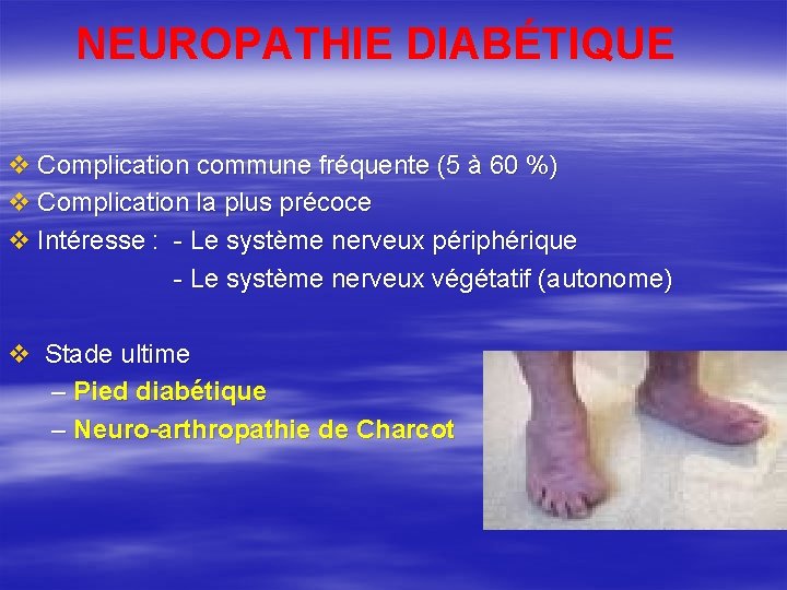 NEUROPATHIE DIABÉTIQUE v Complication commune fréquente (5 à 60 %) v Complication la plus