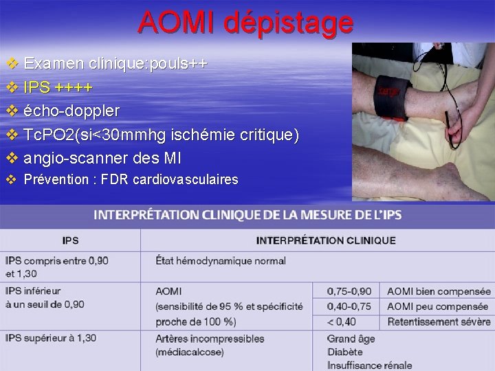 AOMI dépistage v Examen clinique: pouls++ v IPS ++++ v écho-doppler v Tc. PO