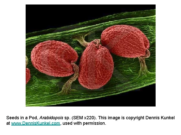 Seeds in a Pod, Arabidopsis sp. (SEM x 220). This image is copyright Dennis