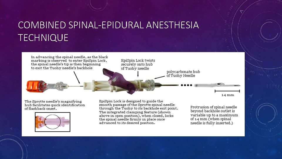 COMBINED SPINAL-EPIDURAL ANESTHESIA TECHNIQUE COMBINED SPINAL-EPIDURAL ANESTHESIA TECHNIQUE