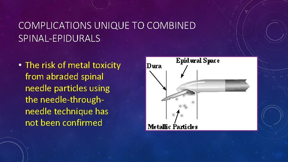 COMPLICATIONS UNIQUE TO COMBINED SPINAL-EPIDURALS • The risk of metal toxicity from abraded spinal