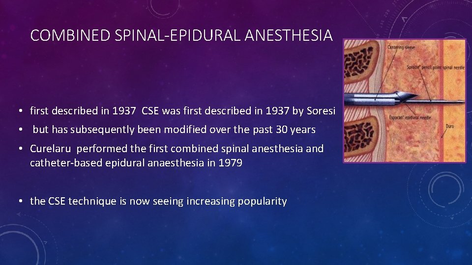 COMBINED SPINAL-EPIDURAL ANESTHESIA • first described in 1937 CSE was first described in 1937 COMBINED SPINAL-EPIDURAL ANESTHESIA • first described in 1937 CSE was first described in 1937