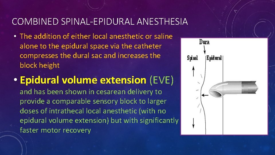 COMBINED SPINAL-EPIDURAL ANESTHESIA • The addition of either local anesthetic or saline alone to