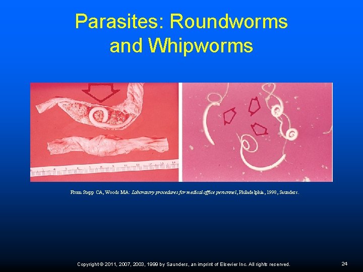 Parasites: Roundworms and Whipworms From Stepp CA, Woods MA: Laboratory procedures for medical office