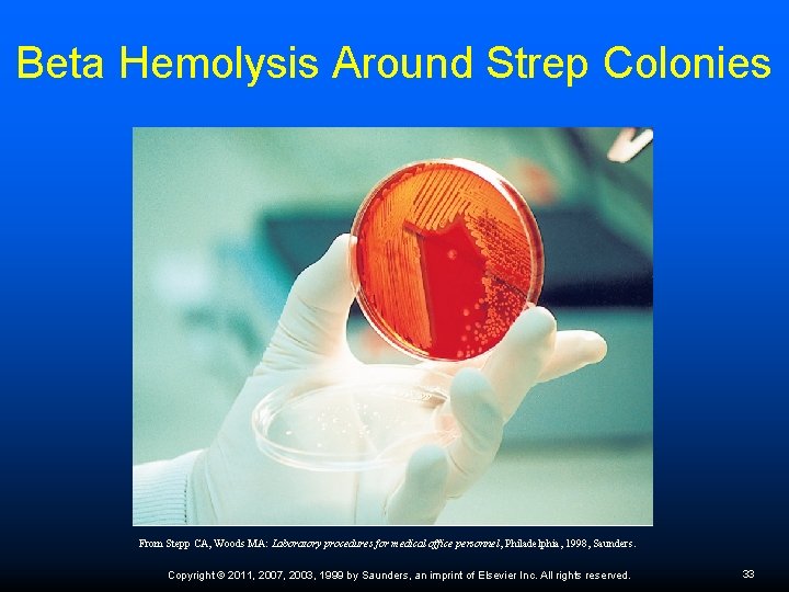 Beta Hemolysis Around Strep Colonies From Stepp CA, Woods MA: Laboratory procedures for medical