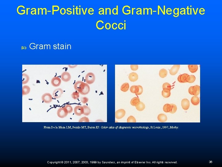 Gram-Positive and Gram-Negative Cocci Gram stain From De la Maza LM, Pezzlo MT, Baron