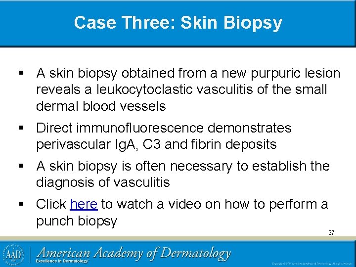Case Three: Skin Biopsy § A skin biopsy obtained from a new purpuric lesion